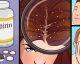 9 Usos alternativos de la aspirina que nadie te había contado