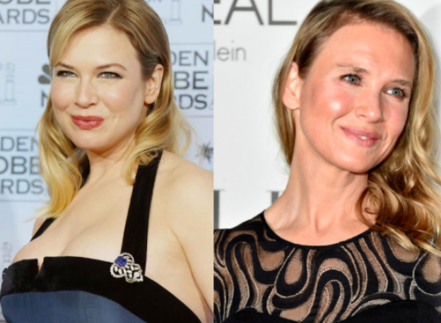 renee zellweger