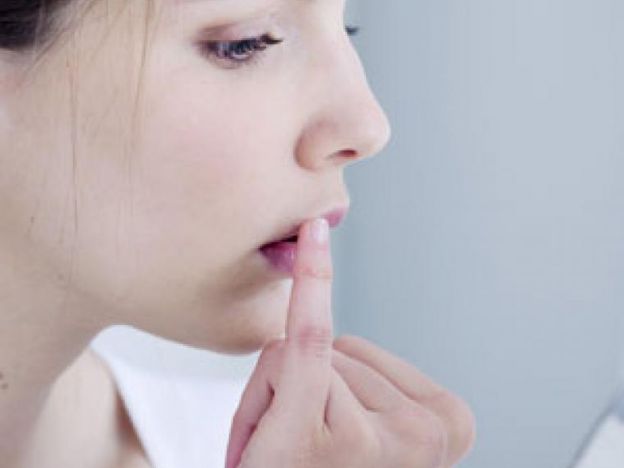 ¿qUÉ ES UN HERPES LABIAL?