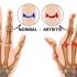 Alivia la artritis y el reumatismo
