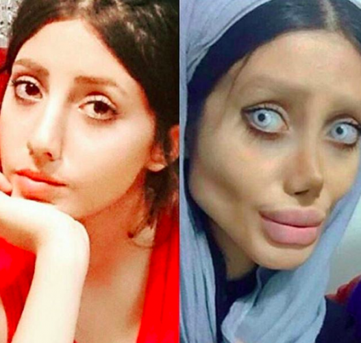 EL ANTES Y EL DESPUÉS