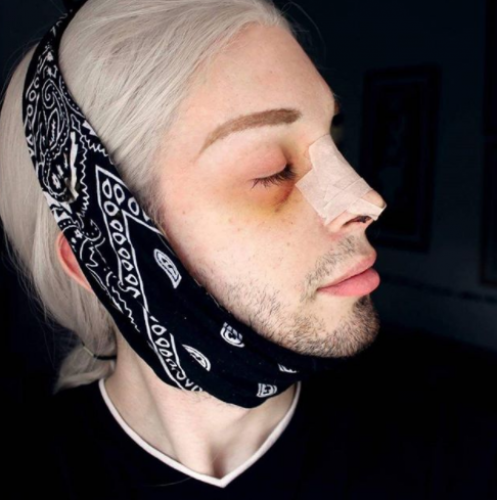 ESTE ES LOUIS PADRON,