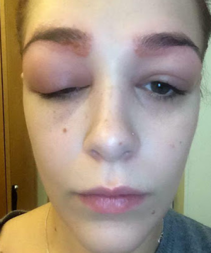 Reacción de tatuarse las cejas I