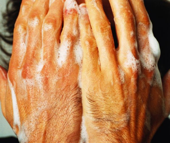 ¿qué es la dermatitis?