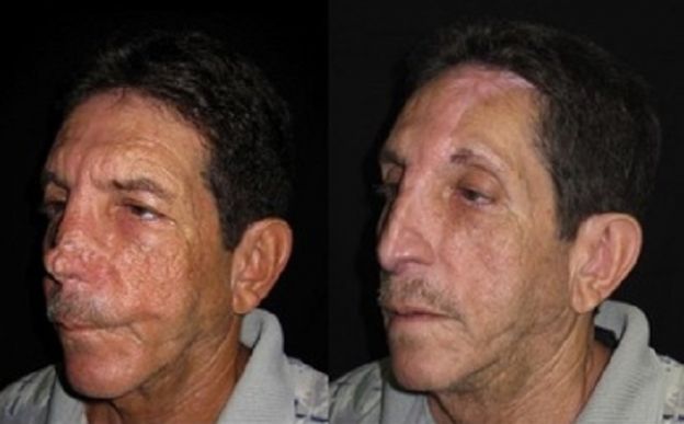 11 casos de CIRUGÍA PLÁSTICA que le CAMBIARON LA VIDA a estas personas