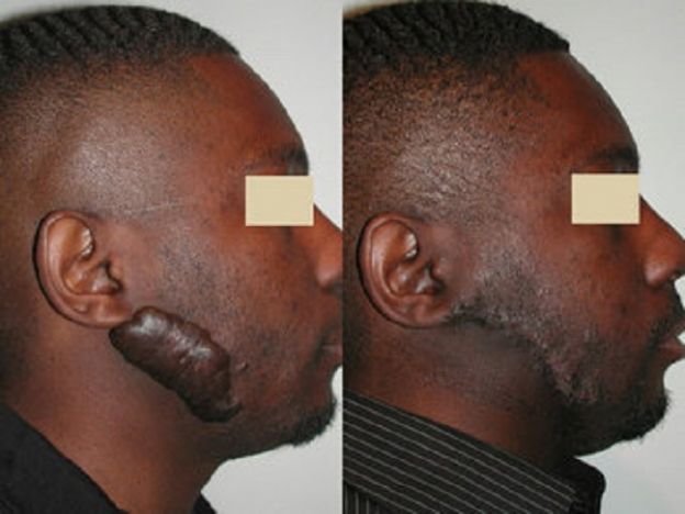 11 casos de CIRUGÍA PLÁSTICA que le CAMBIARON LA VIDA a estas personas