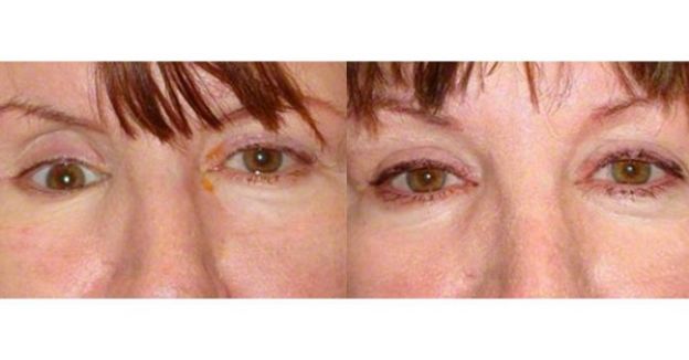 11 casos de CIRUGÍA PLÁSTICA que le CAMBIARON LA VIDA a estas personas