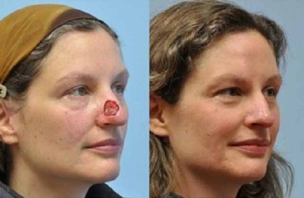 11 casos de CIRUGÍA PLÁSTICA que le CAMBIARON LA VIDA a estas personas