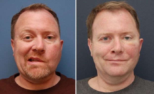 11 casos de CIRUGÍA PLÁSTICA que le CAMBIARON LA VIDA a estas personas