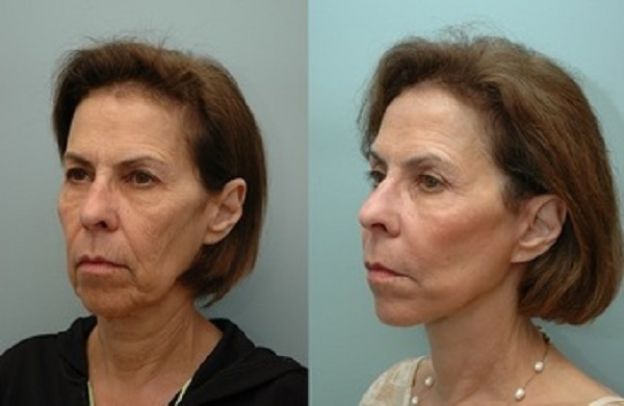 11 casos de CIRUGÍA PLÁSTICA que le CAMBIARON LA VIDA a estas personas