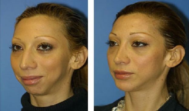 11 casos de CIRUGÍA PLÁSTICA que le CAMBIARON LA VIDA a estas personas