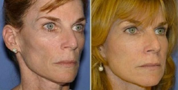 11 casos de CIRUGÍA PLÁSTICA que le CAMBIARON LA VIDA a estas personas