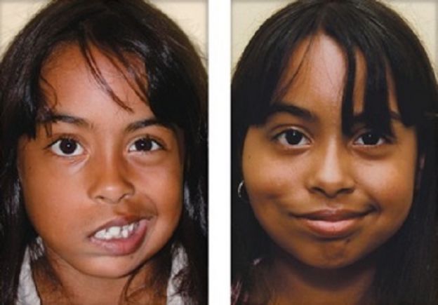 11 casos de CIRUGÍA PLÁSTICA que le CAMBIARON LA VIDA a estas personas