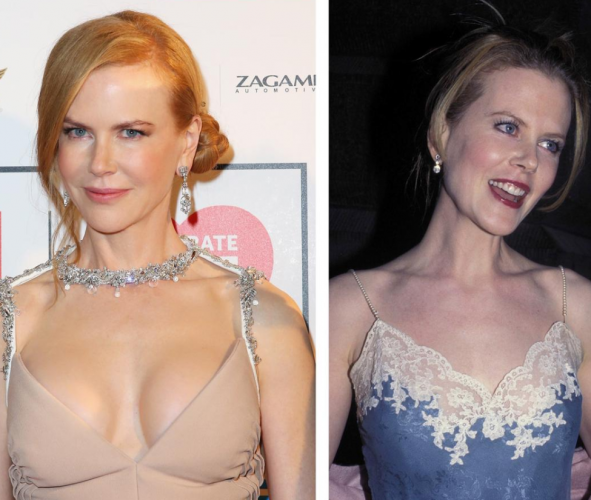 NICOLE KIDMAN