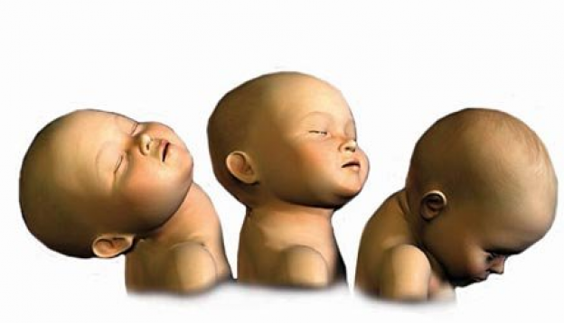 LA CABEZA DEL BEBÉ ES MUY DELICADA