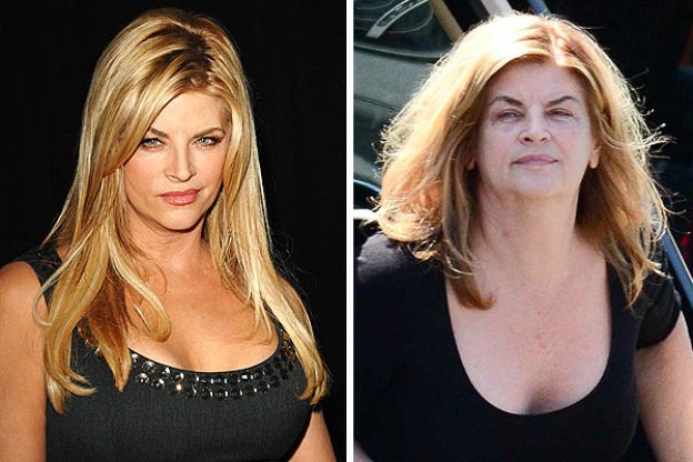 Kirstie Alley
