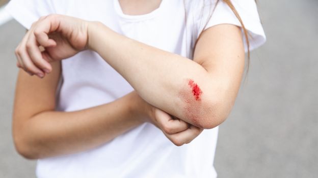 No tratarte las heridas