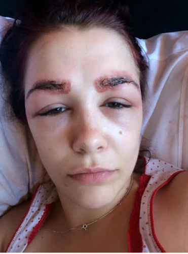 Reacción de tatuarse las cejas II