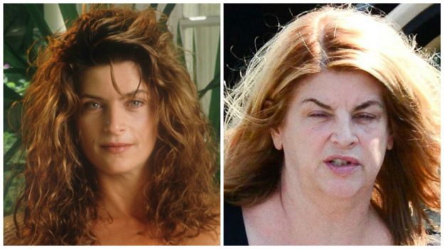 Kristie Alley