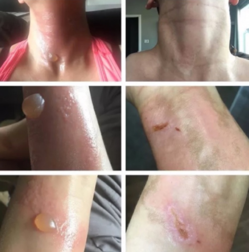 SE NOS PONEN LOS PELOS DE PUNTA