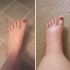 Un increíble remedio natural para aliviar la hinchazón de los pies